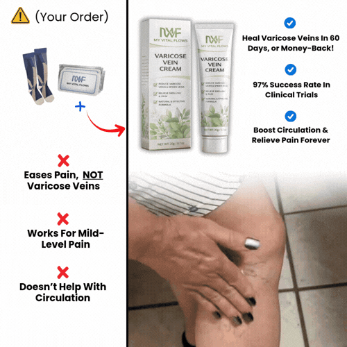 Eliminate Varicose Veins In 60 Days! (One-Time Offer)